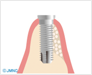 名東区藤が丘・藤が丘デンタルクリニック